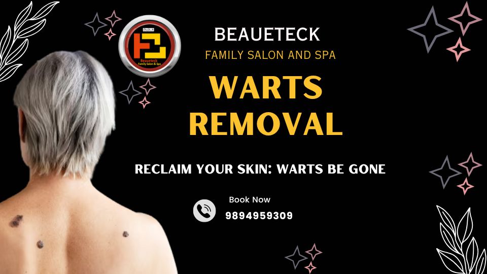 Warts Removal Treatment