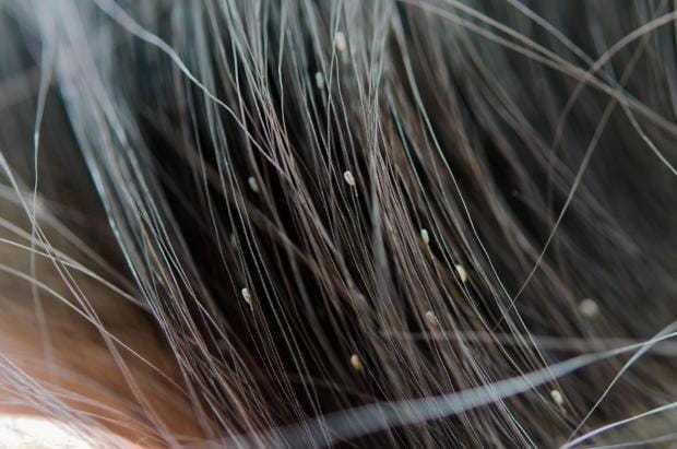 Lice Treatment